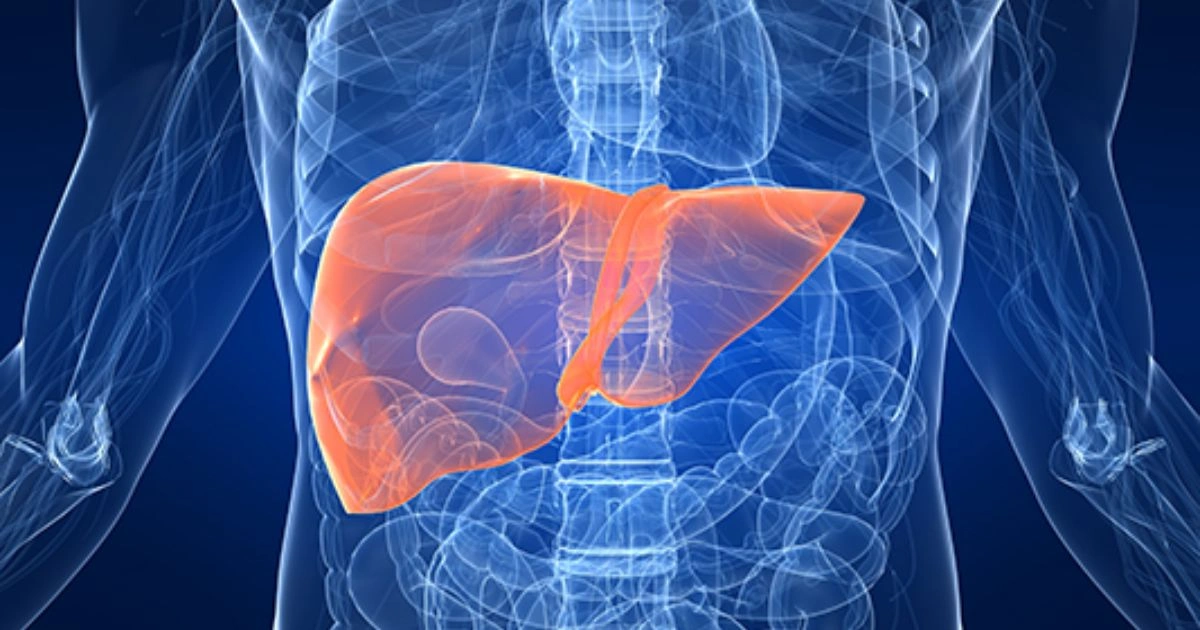 Homeopathic liver treatment consultation for managing fatty liver